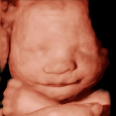 Gallery of Baby Scan Images | Your Baby Scan